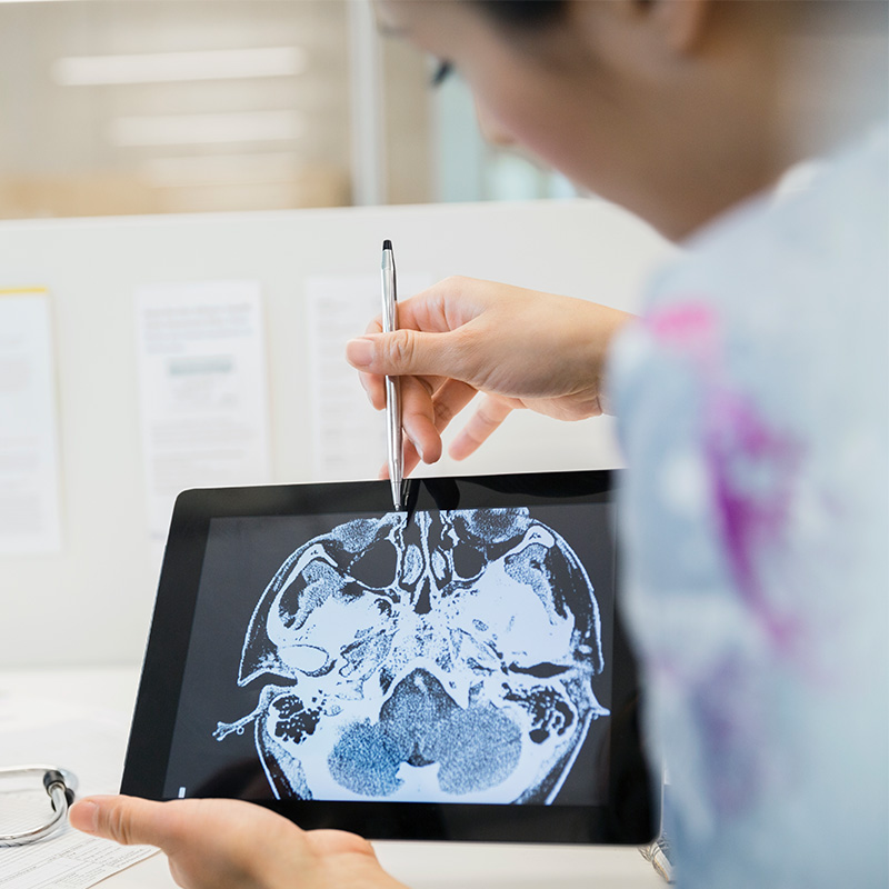 Neuro doctors understanding a patient scan 